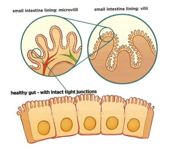 What is leaky gut
